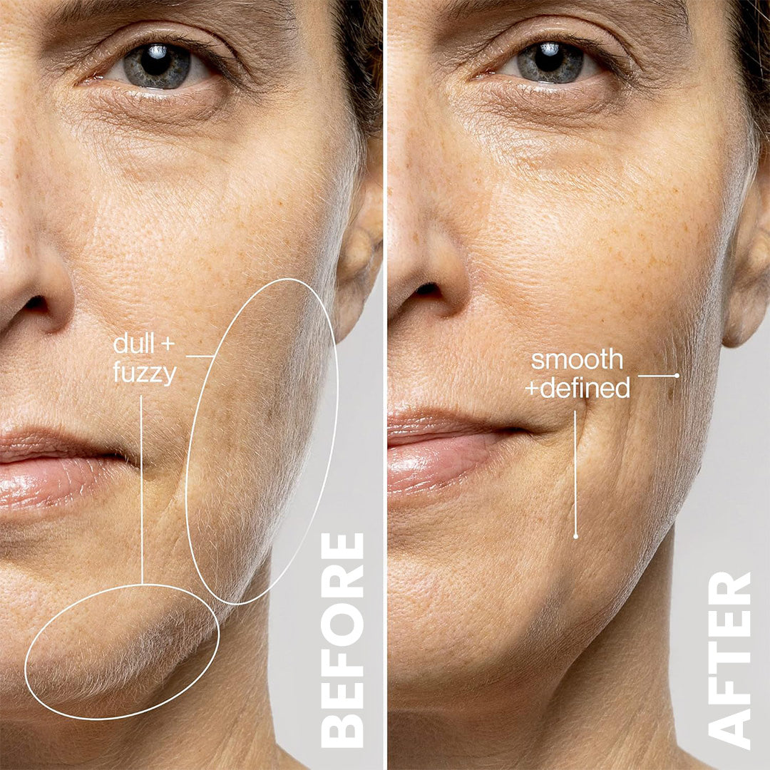 3x Blad Erstatninger / 3 måneders forbruk ($7.95/hver)