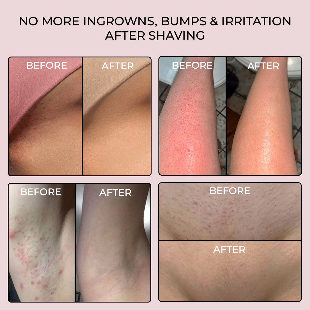 5MINSKIN ELEKTRISK BARBERMASKIN FOR KVINNER - 50% RABATT INTERNASJONAL KVINNEDAGSSALG