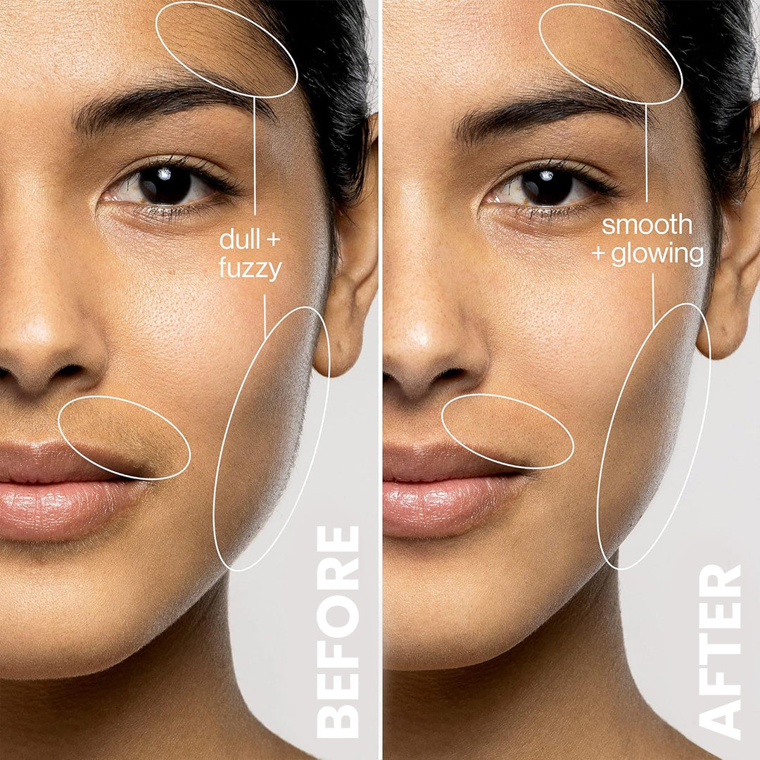 3x Blad Erstatninger / 3 måneders forbruk ($7.95/hver)