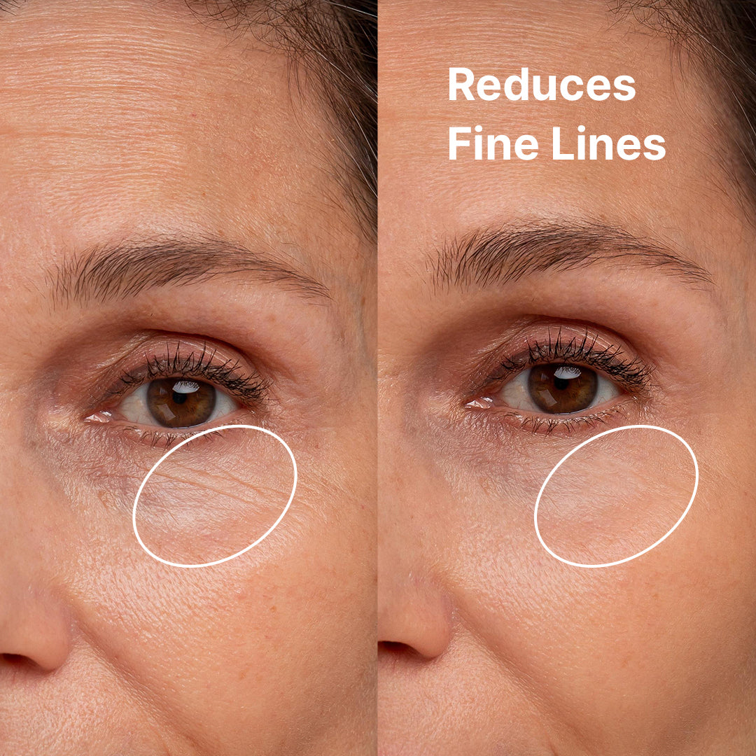 2x Blad Erstatninger ($14.99/stk)