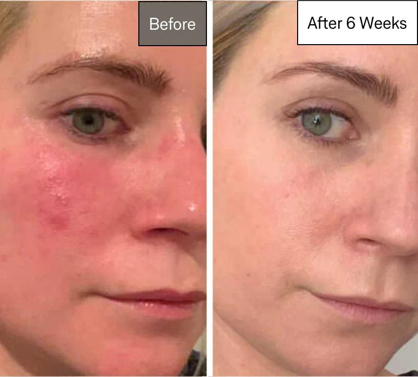 5MinSkin 2.0 GRUNNPakke Pro