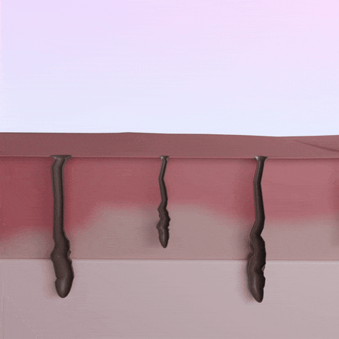 5MINSKIN-HAIR-ZAPPER-2.0 HJEMME-LASER-HÅRFJERNINGS-ENHET