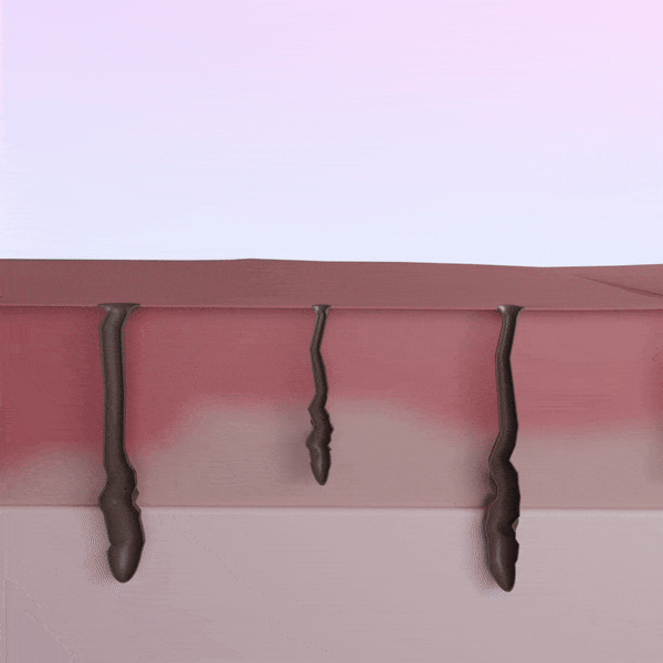 5MINSKIN-HAIR-ZAPPER-2.0 HJEMME-LASER-HÅRFJERNINGS-ENHET