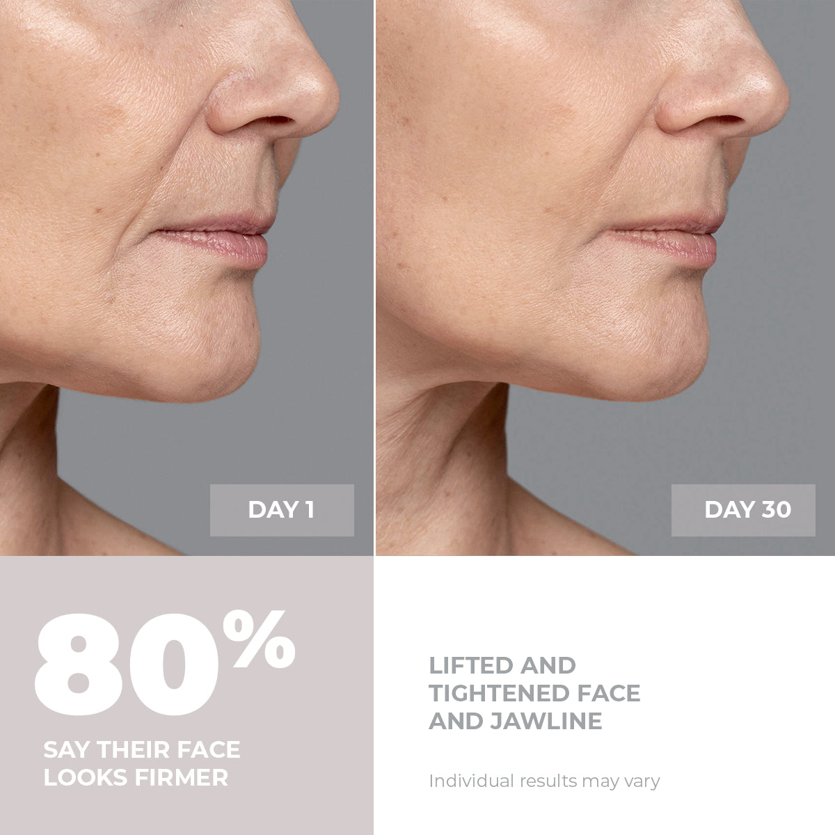 5MinSkin MicroSculpt + Hyaluronsyre Serum (30 Dagers Forsyning)